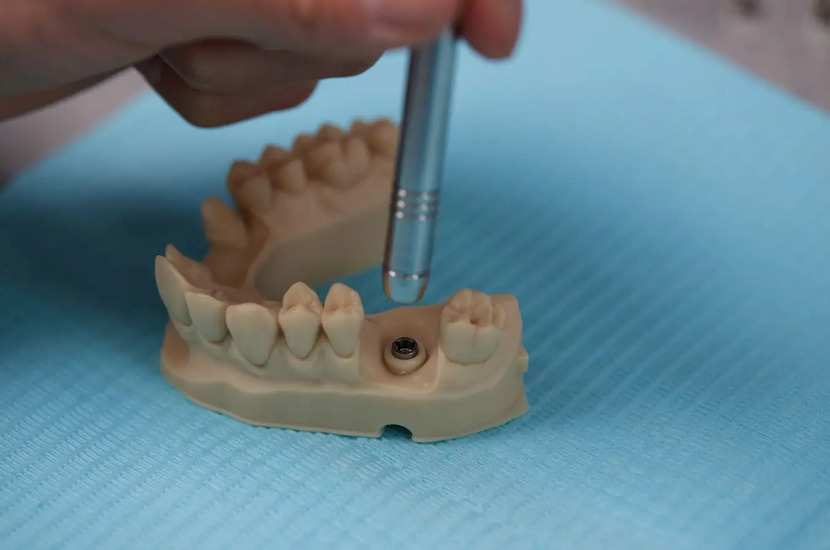 lcd 3d printing materials guide_formlabs dental resin